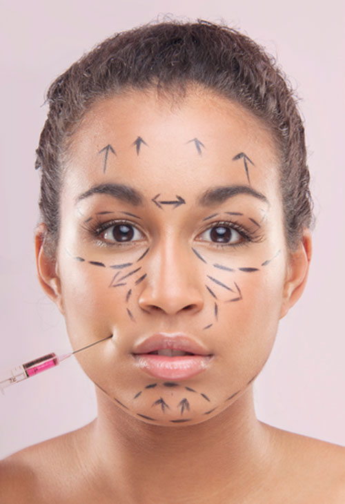 Botox-Injektionen